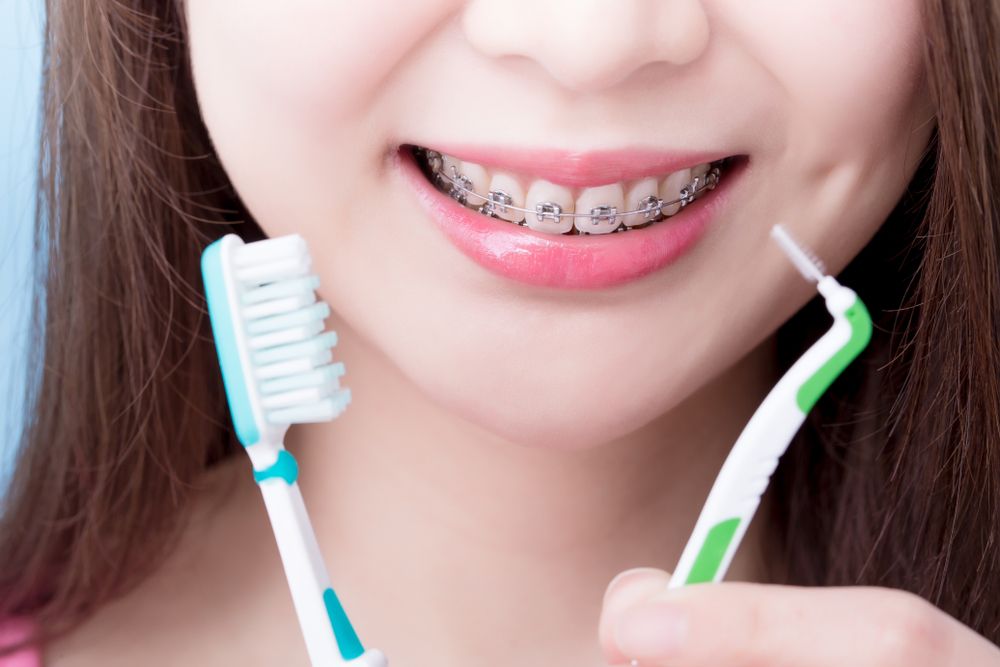 How Often Should I Brush My Teeth with Braces
