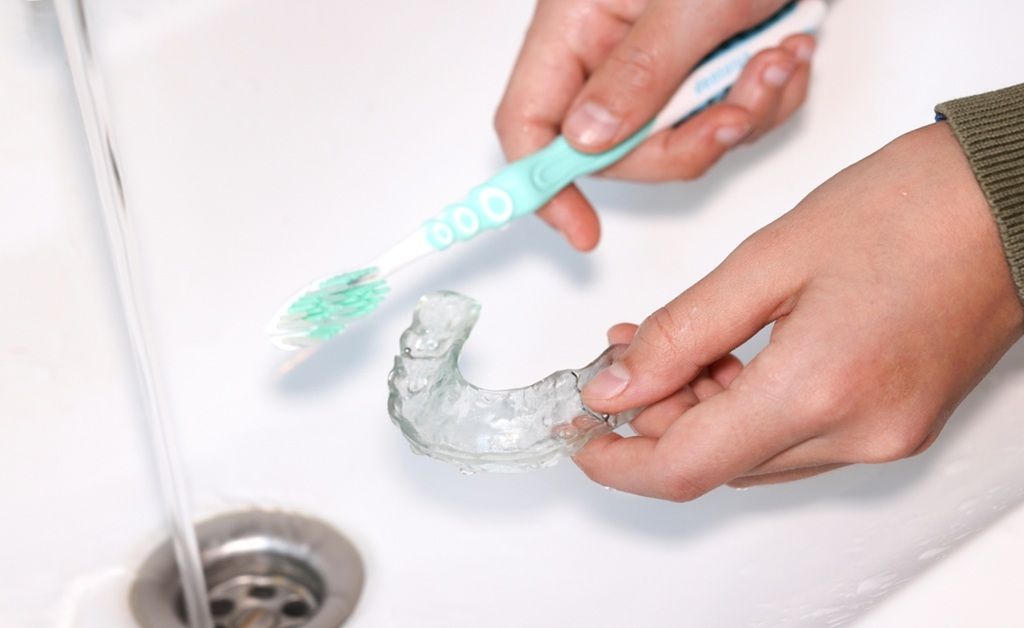 How to Clean Plastic Dental Retainers at Home Safely