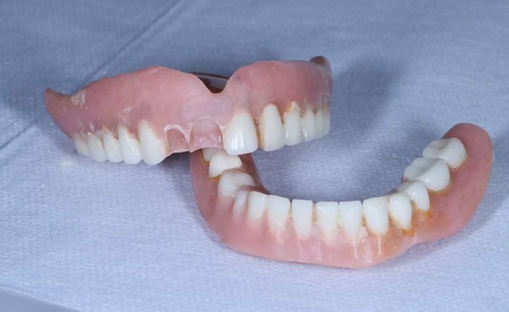 How to Repair a Broken Denture the Right Way
