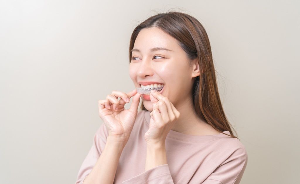 How Long Does It Take for Invisalign to Work?